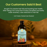 Kerala Ayurveda Bhringarajasava | Ayurvedic Hair Growth Tonic & Hair Fall Control | Herbal Oral Tonic with Bhringraj for Scalp Nourishment & Natural Shine | 450 ml